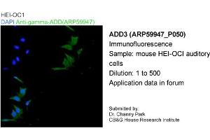 Image no. 1 for anti-Adducin 3 (Gamma) (ADD3) (Middle Region) antibody (ABIN786069) (ADD3 antibody  (Middle Region))
