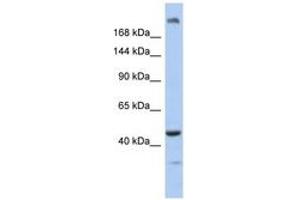 KIAA0284 anticorps  (AA 551-600)
