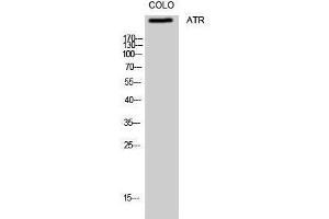 Western Blotting (WB) image for anti-ATR serine/threonine kinase (ATR) (Ser16) antibody (ABIN3173961) (ATR antibody  (Ser16))
