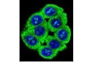 Confocal immunofluorescent analysis of PATL2 Antibody (PATL2 antibody  (Middle Region))