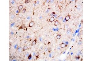 IHC-P: nNOS antibody testing of rat brain tissue (NOS1 antibody  (C-Term))