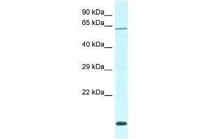 WB Suggested Anti-Dcaf11 Antibody   Titration: 1.