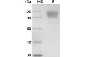 Western Blotting (WB) image for Tumor Necrosis Factor Receptor Superfamily, Member 8 (TNFRSF8) protein (mFc Tag) (ABIN7319925) (TNFRSF8 Protein (mFc Tag))