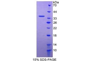 SDS-PAGE (SDS) image for GATA Binding Protein 2 (GATA2) (AA 175-480) protein (His tag) (ABIN2124934) (GATA2 Protein (AA 175-480) (His tag))