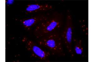 Proximity Ligation Analysis of protein-protein interactions between AKT1 and PPM1A. (PPM1A antibody  (AA 1-382))