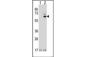 Western blot analysis of FASTK (arrow) using FAST kinase (C-term) Antibody (C-term) Cat. (FASTK antibody  (C-Term))