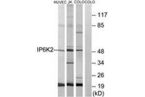 Western blot analysis of extracts from HuvEc/COLO/Jurkat cells, using IP6K2 Antibody. (IP6K2 antibody  (AA 161-210))