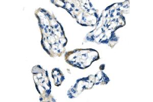 IHC analysis of Glycine decarboxylase/GLDC using anti-Glycine decarboxylase/GLDC antibody (ABIN7602073). (GLDC antibody  (AA 574-1020))