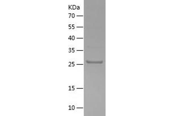 FGF3 Protein (AA 13-239) (His tag)