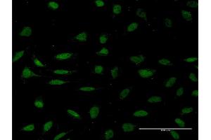 Immunofluorescence of monoclonal antibody to HMGXB4 on HeLa cell. (HMGXB4 antibody  (AA 1-74))