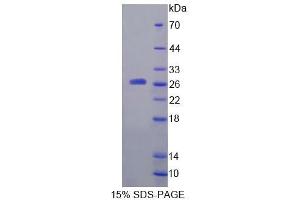 SDS-PAGE analysis of Rat a4GALT Protein. (A4GALT Protein)