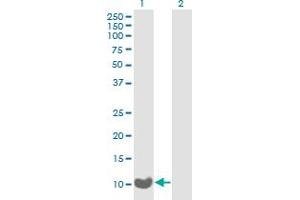 Western Blot analysis of C17orf37 expression in transfected 293T cell line by C17orf37 monoclonal antibody (M02), clone 3B5. (C17orf37 antibody  (AA 1-115))