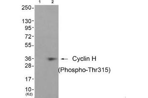 Western blot analysis of extracts from JK cells (Lane 2), using Cyclin H (Phospho-Thr315) Antibody. (Cyclin H antibody  (pThr315))
