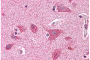 Human Brain, Cortex: Formalin-Fixed, Paraffin-Embedded (FFPE) (BRE antibody  (AA 9-338))