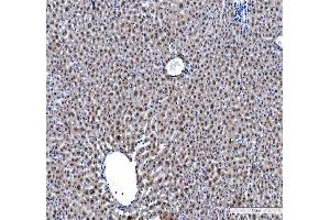 IHC analysis of hnRNP L/HNRNPL using anti-hnRNP L/HNRNPL antibody (ABIN7600130). (HNRNPL antibody  (AA 152-569))