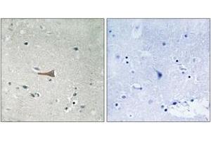 Immunohistochemistry (IHC) image for anti-Discoidin Domain Receptor tyrosine Kinase 1 (DDR1) (AA 479-528), (pTyr513) antibody (ABIN1532104)