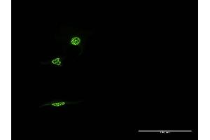Immunofluorescence of monoclonal antibody to NR1D1 on HeLa cell. (NR1D1 antibody  (AA 233-322))