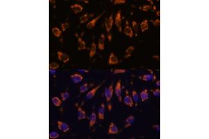 Immunofluorescence analysis of L929 cells using CRELD1 antibody (ABIN7266621) at dilution of 1:100.