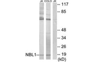 Western blot analysis of extracts from Jurkat/COLO cells, using NBL1 Antibody. (NBL1 antibody  (AA 131-180))