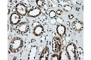 Immunohistochemical staining of paraffin-embedded Kidney tissue using anti-PLEKmouse monoclonal antibody. (Pleckstrin antibody)
