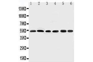 Anti-Smad2 antibody, Western blotting Lane 1: Rat Brain Tissue Lysate Lane 2: HELA Cell Lysate Lane 3: SMMC Cell Lysate Lane 4: JURKAT Cell Lysate Lane 5: U87 Cell Lysate Lane 6: MCF-7 Cell Lysate (SMAD2 antibody  (N-Term))