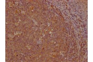 IHC image of ABIN7154410 diluted at 1:200 and staining in paraffin-embedded human tonsil tissue performed on a Leica BondTM system. (GNLY antibody  (AA 23-145))
