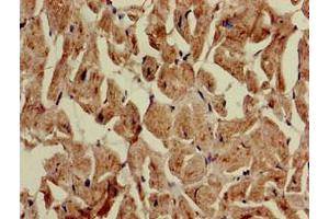 Immunohistochemistry of paraffin-embedded human heart tissue using ABIN7149026 at dilution of 1:100 (ATG4C antibody  (AA 419-448))
