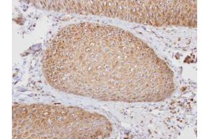IHC-P Image Immunohistochemical analysis of paraffin-embedded human normal oral, using PTGFRN, antibody at 1:100 dilution. (PTGFRN antibody  (C-Term))