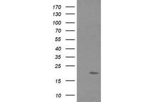 Image no. 2 for anti-Fetal and Adult Testis Expressed 1 (FATE1) antibody (ABIN1498224) (FATE1 antibody)