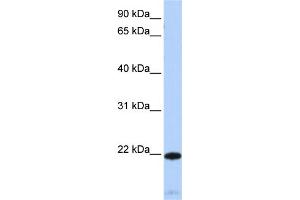 WB Suggested Anti-RGS5 Antibody Titration:  0.