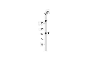 Anti-ZCCHC14 Antibody (Center) at 1:1000 dilution + Hela whole cell lysate Lysates/proteins at 20 μg per lane. (ZCCHC14 antibody  (AA 420-449))