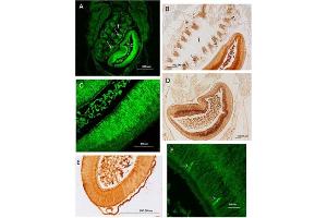 Immunohistochemistry results using Anti-Carbonic Anhydrase II (RABBIT) Antibody. (CA2 antibody)