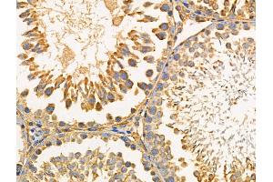 ABIN6259144 and ABIN6274444 at 1/100 staining Rat testis tissue by IHC-P.
