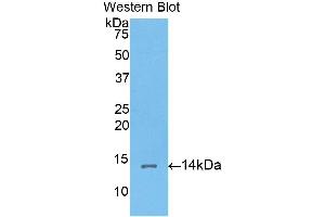 Western Blotting (WB) image for anti-Corin, Serine Peptidase (CORIN) (AA 533-634) antibody (ABIN3203375) (Corin antibody  (AA 533-634))