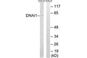 Western blot analysis of extracts from COLO cells, using DNAI1 Antibody. (DNAI1 antibody  (AA 211-260))