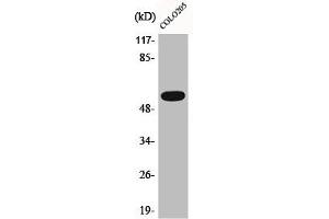 Western Blot analysis of COLO205 cells using Phospho-Akt (T308) Polyclonal Antibody (AKT 1/2/3 antibody  (pThr308))