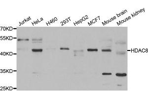 Western blot analysis of extracts of various cell lines, using HDAC8 antibody. (HDAC8 antibody)