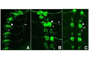 Immunofluorescence (IF) image for anti-Green Fluorescent Protein (GFP) antibody (ABIN100085)