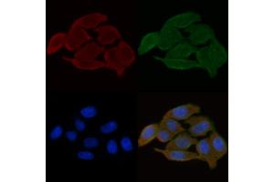 ABIN6259279 and ABIN6275588 staining Hela cells(30 min of UV treatment) by IF/ICC.