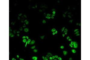 Detection of Hsp27 in Human Hela Cell using Polyclonal Antibody to Heat Shock Protein 27 (Hsp27) (HSP27 antibody  (AA 1-201))