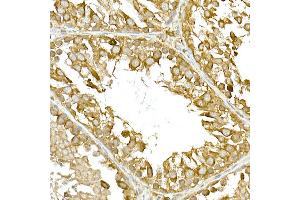 Immunohistochemistry (IHC) image for anti-TANK-Binding Kinase 1 (TBK1) (AA 440-729) antibody (ABIN3016268)