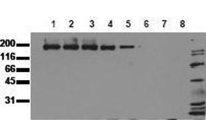 Western Blotting (WB) image for anti-Epidermal Growth Factor Receptor (EGFR) (Extracellular Domain) antibody (ABIN126784) (EGFR antibody  (Extracellular Domain))
