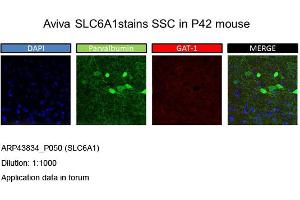 Image no. 2 for anti-GABA Transporter 1 (GAT1) (Middle Region) antibody (ABIN2781581) (SLC6A1 antibody  (Middle Region))