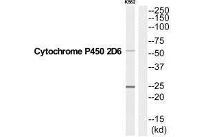 Western blot analysis of extracts from K562 cells, using CYP2D6 antibody. (CYP2D6 antibody  (C-Term))