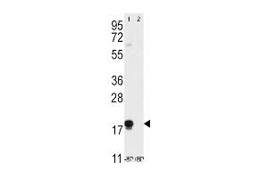 Western blot analysis of anti-THY1 (N-term) Pab (ABIN388803 and ABIN2839126) pre-incubated without(lane 1) and with(lane 2) blocking peptide (BP2050a) in T47D cell line lysate. (CD90 antibody  (N-Term))