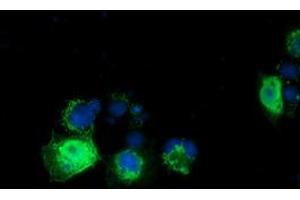 Anti-RASD2 mouse monoclonal antibody (ABIN2453586) immunofluorescent staining of COS7 cells transiently transfected by pCMV6-ENTRY RASD2 (RC201454). (RASD2 antibody)