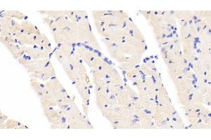 Detection of BACE2 in Mouse Cardiac Muscle Tissue using Polyclonal Antibody to Beta Secretase 2 (BACE2) (BACE2 antibody  (AA 156-407))