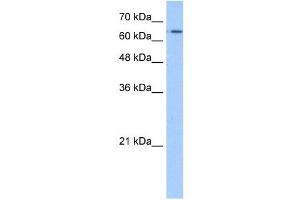 WB Suggested Anti-SLC22A11 Antibody Titration:  1. (SLC22A11 antibody  (N-Term))