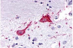 Immunohistochemical (Formalin/PFA-fixed paraffin-embedded sections) staining in human brain, neurons and glia with KISS1R polyclonal antibody . (KISS1R antibody  (3rd Cytoplasmic Domain))