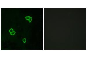 Immunofluorescence analysis of LOVO cells, using LPHN1 antibody. (Latrophilin 1 antibody  (Internal Region))